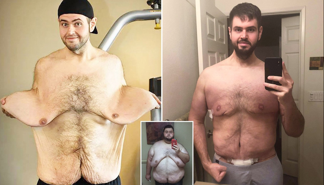 Συγκλονιστικό: Έχασε 140 κιλά, μεταμορφώθηκε και παντρεύτηκε τη γυναίκα της ζωής του (ΦΩΤΟ)