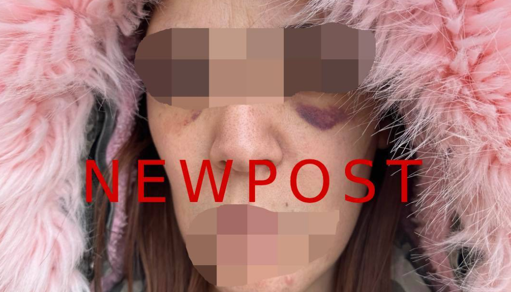 Με μώλωπες στο δικαστήριο η 32χρονη που κακοποιήθηκε από τον σύζυγό της - "Βλέπω εφιάλτες τις εικόνες που με χτύπαγε" (Vid)