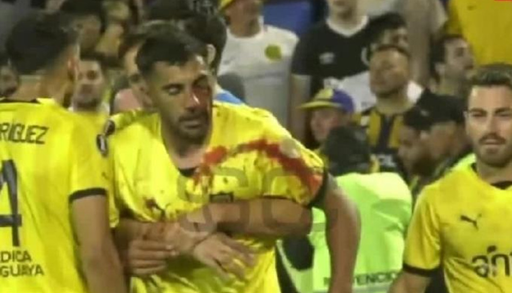 Σοκαριστικό βίντεο: Ποδοσφαιριστής δέχθηκε πέτρα στο μάτι - Πήγε να επιτεθεί στους οπαδούς