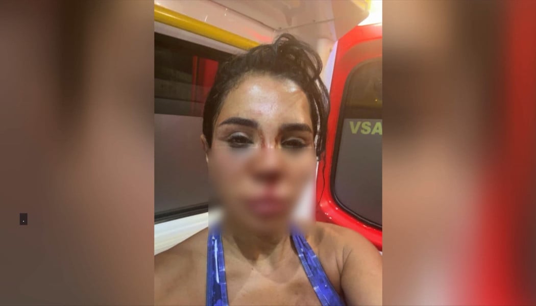 Τρόμος για influencer – Διαρρήκτες την χτύπησαν και την ψέκασαν με χλωρίνη