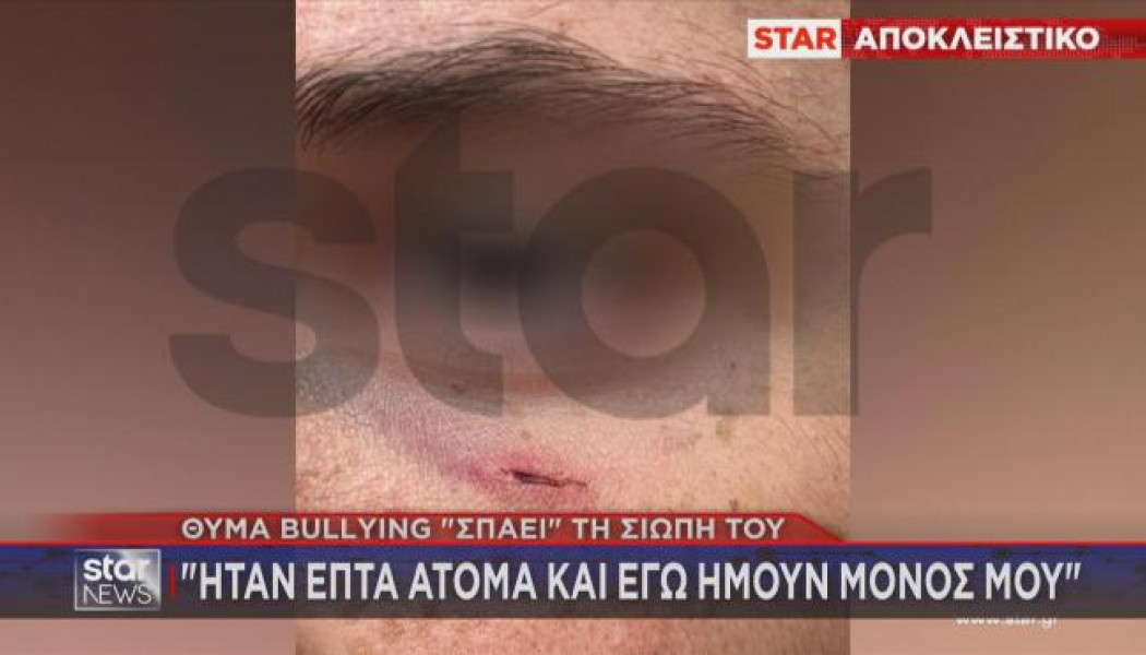 Άγριο ξύλο σε 14χρονο μαθητή Γυμνασίου για μια λάθος πάσα στο μπάσκετ! (VD)