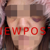 Άργος