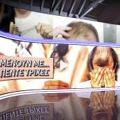 Τριχόπτωση