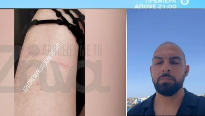Μύκονος: Ο απίστευτος λόγος που αστυνομικοί ξυλοκόπησαν διαβητικό άνδρα