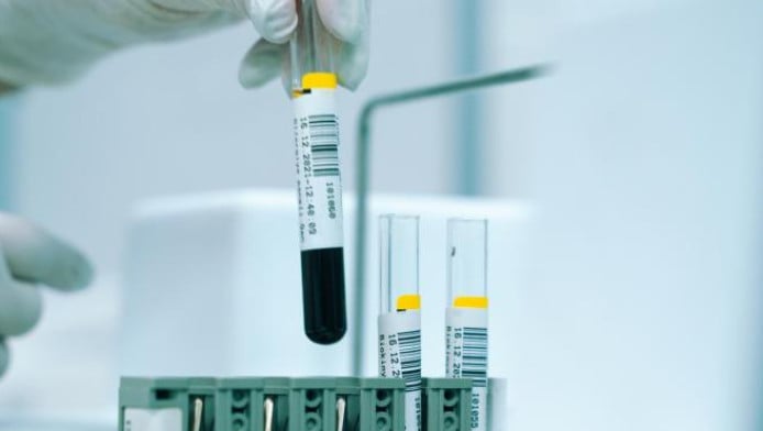 Αιματολογική εξέταση ανιχνεύει τον καρκίνο τρία χρόνια πριν τη διάγνωση