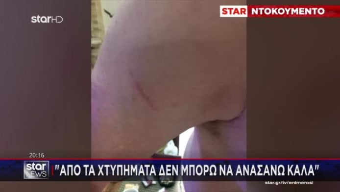Κερατσίνι: Άγριο ξύλο με σιδερογροθιές για μία παρατήρηση (Vid)