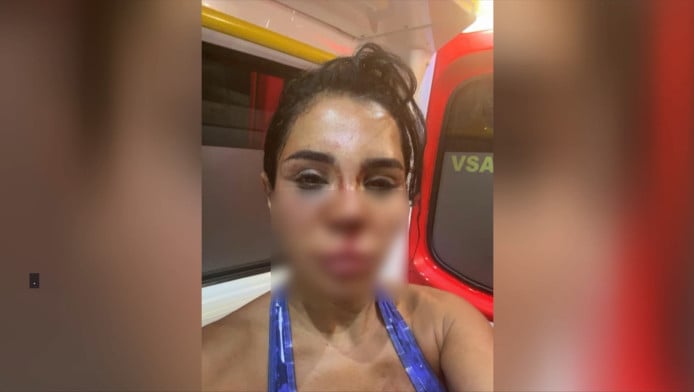 Τρόμος για influencer – Διαρρήκτες την χτύπησαν και την ψέκασαν με χλωρίνη