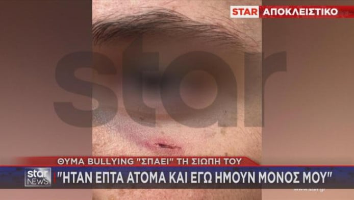 Άγριο ξύλο σε 14χρονο μαθητή Γυμνασίου για μια λάθος πάσα στο μπάσκετ! (VD)