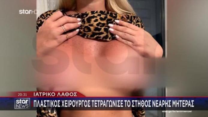 Πλαστικός χειρουργός της... τετραγώνισε το στήθος: "Χειροτέρευα συνεχώς"