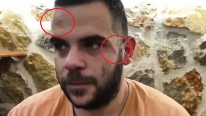 Χτύπησαν άγρια γνωστό Youtuber σε live μετάδοση στα Γιάννενα! (BINTEO)