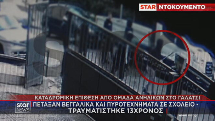 13χρονος δέχθηκε βεγγαλικό την ώρα της γυμναστικής σε σχολείο (ΒΙΝΤΕΟ)