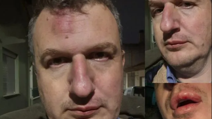 Μαφιόζικη επίθεση κατά εκδότη εφημερίδας 