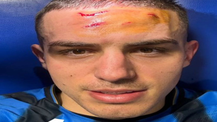 Champions League: Το σοκαριστικό «σουβενίρ» του Κρστόβιτς! (pic)