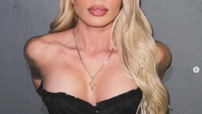 Γνωστή Ελληνίδα τραγουδίστρια παραδέχθηκε τις πλαστικές που έκανε! (ΒΙΝΤΕΟ)