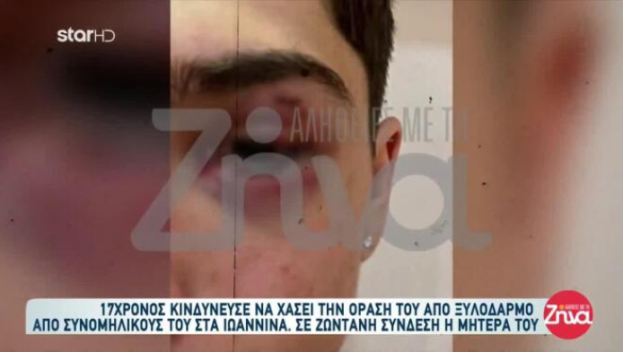 Σοκάρει η μητέρα του 17χρονου - «Πήγαν να σκοτώσουν το παιδί μου» (ΒΙΝΤΕΟ)