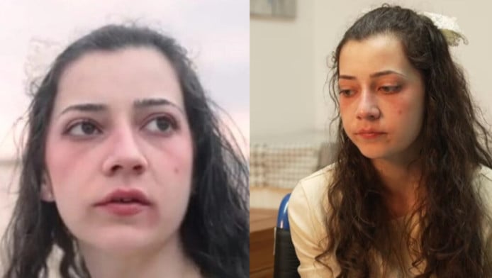 Πέθανε η Καστίγιο μόλις 25 ετών! Όλος ο πλανήτης δάκρυσε με την ιστορία της