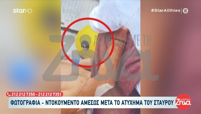Survivor: ΦΩΤΟ αμέσως μετά τον τραυματισμό του Φλώρου - «Τέλος τα ψέματα»!
