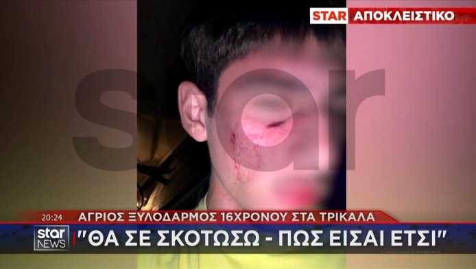 Τρίκαλα: Άγριος ξυλοδαρμός 16χρονου - «Θα σε σκοτώσω, πώς είσαι έτσι;» (Vd)