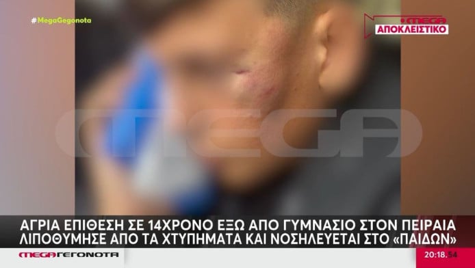 Στο νοσοκομείο 14χρονος μετά από ξυλοδαρμό συμμαθητή του (ΒΙΝΤΕΟ)