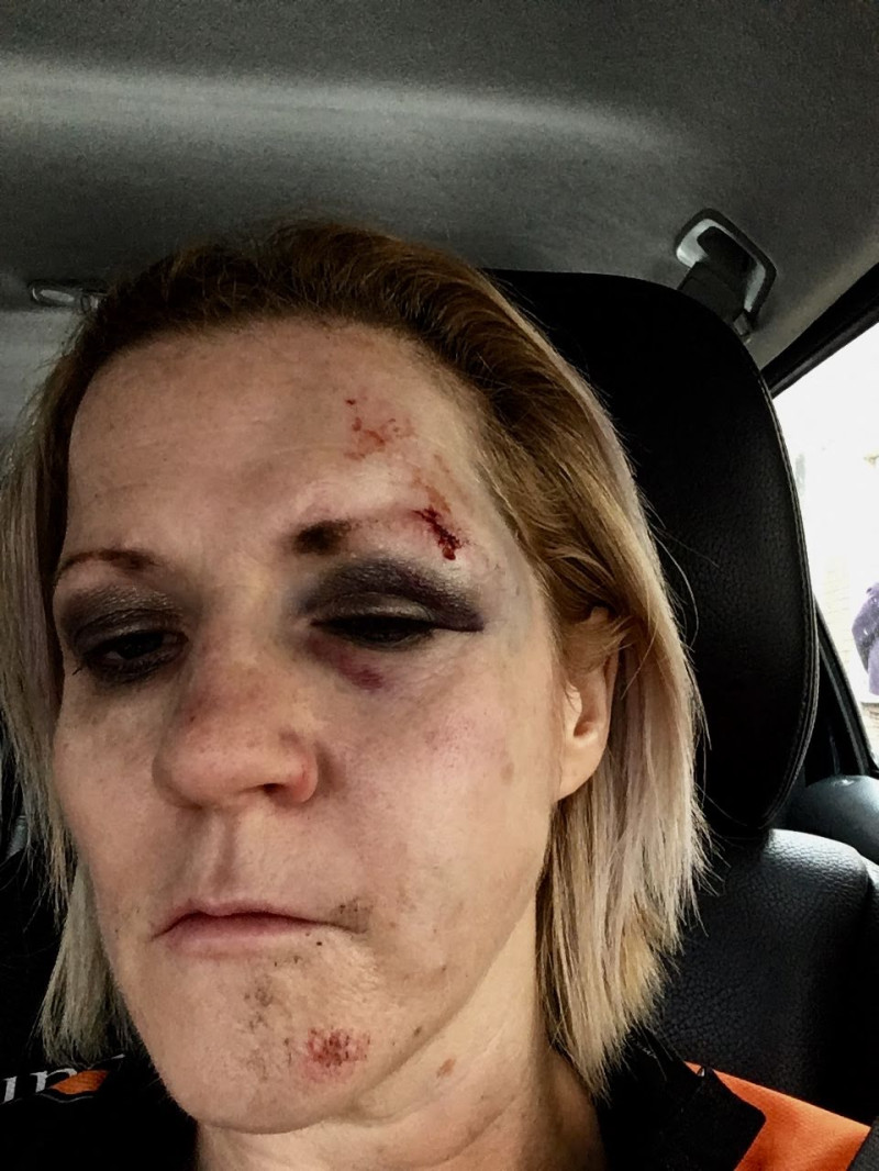 Όλες οι... κατάρες πάνω της: Γυναίκα παραλίγο να πεθάνει επτά φορές (ΦΩΤΟ)