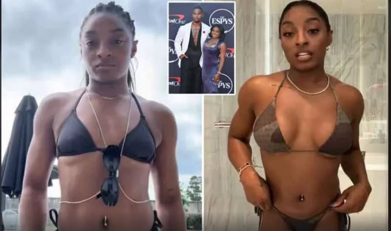 Κορυφαία αθλήτρια έκανε πλαστική στήθους - Εντυπωσιακό το πριν και μετά!