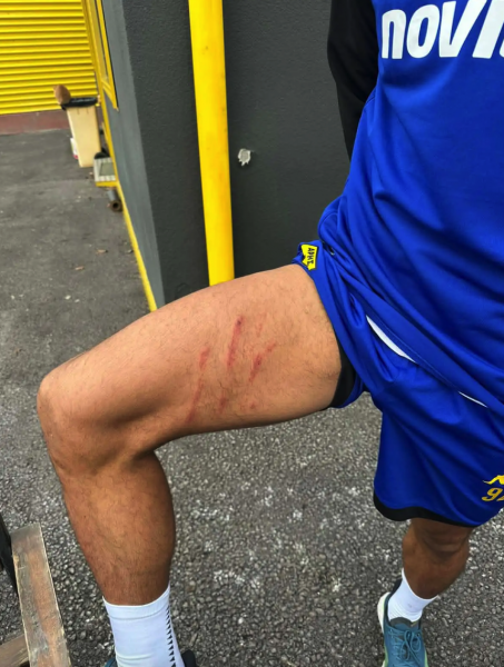 Γι’ αυτό ζητά κόκκινη ο Άρης - Τα σημάδια στο πόδι του Ρόουζ (ΦΩΤΟ)