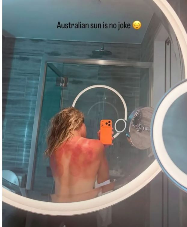 Tενίστρια μοιράστηκε μια γυμνή φωτογραφία της από το μπάνιο (ΦΩΤΟ)