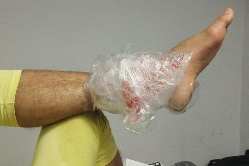 Με πάγο ο Τζολάκης από το πάτημα Γερεμέγιεφ - Δείτε τη φάση (ΒΙΝΤΕΟ-ΦΩΤΟ)